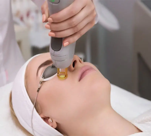 laser treatment for face