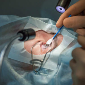 LASIK doctor in Chicago