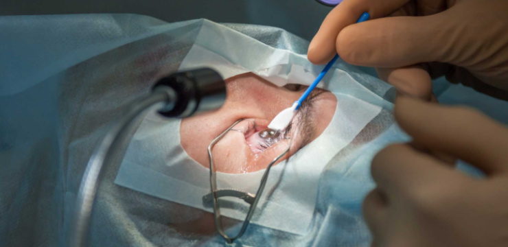 LASIK doctor in Chicago