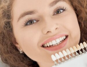 Porcelain Dental Veneers: How They Improve Smile Appearance 3 Porcelain dental veneers
