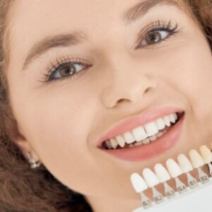 Porcelain dental veneers
